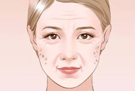 如何有效去除老年斑——全方位解析，全方位解析，有效去除老年斑的方法