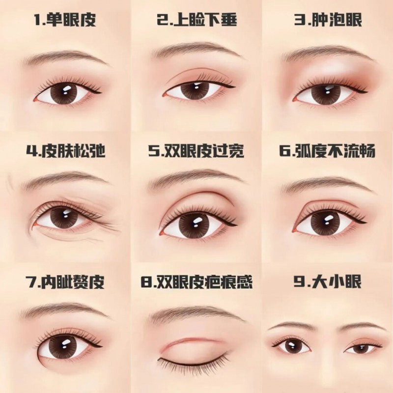 雙眼皮下垂怎么解決——專業方法與日常護理建議，雙眼皮下垂解決方法，專業方法與日常護理指南