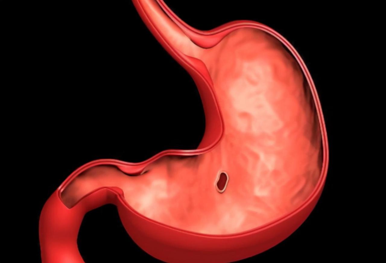 做胃鏡對胃傷害有多大，深入了解與關注，胃鏡對胃的影響，深入了解與關注