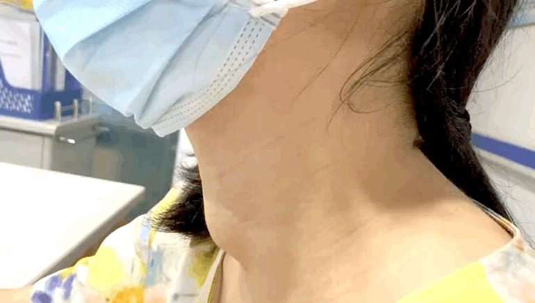 甲狀腺結(jié)節(jié)是被氣的嗎？深入了解甲狀腺結(jié)節(jié)的成因與防治，甲狀腺結(jié)節(jié)成因與防治，情緒因素與疾病關(guān)系探討