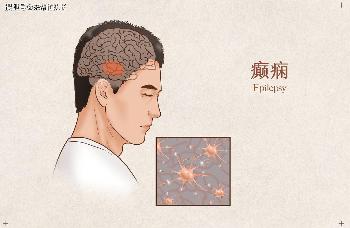 癲瘋病會遺傳下一代嗎，癲癇病遺傳問題，是否會傳給下一代？