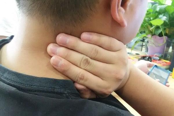 女性甲狀腺早期脖子圖片及其相關(guān)知識(shí)與識(shí)別，女性甲狀腺早期脖子癥狀圖片及識(shí)別與相關(guān)知識(shí)