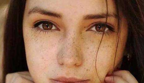 如何淡化臉上的斑，多種方法助你擁有無(wú)瑕肌膚，多種方法助你淡化臉部斑點(diǎn)，重塑無(wú)瑕肌膚