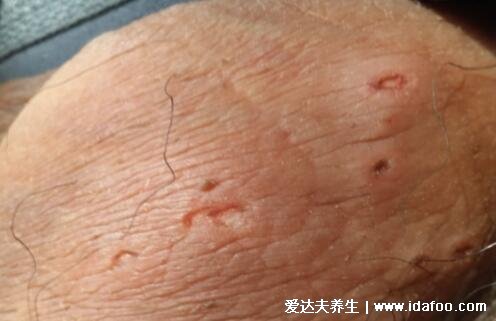 得性疾病前兆，了解、預防與應對，得性疾病的早期信號，了解、預防與應對策略