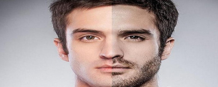 胡子永久去掉的方法，全面解析與推薦最佳策略，胡子永久去掉的方法，全面解析及最佳策略推薦