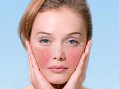 治療紅血絲最好的方法有哪些，紅血絲治療最佳方法解析