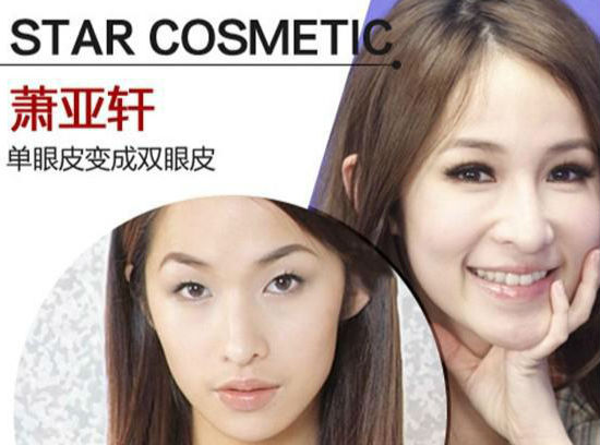 整容成功的人會有后遺癥嗎？探討與解析，整容手術成功后的潛在后遺癥，探討與解析